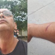 Periodista fue a ver a La Renga y terminó con moretones: "Violencia policial"