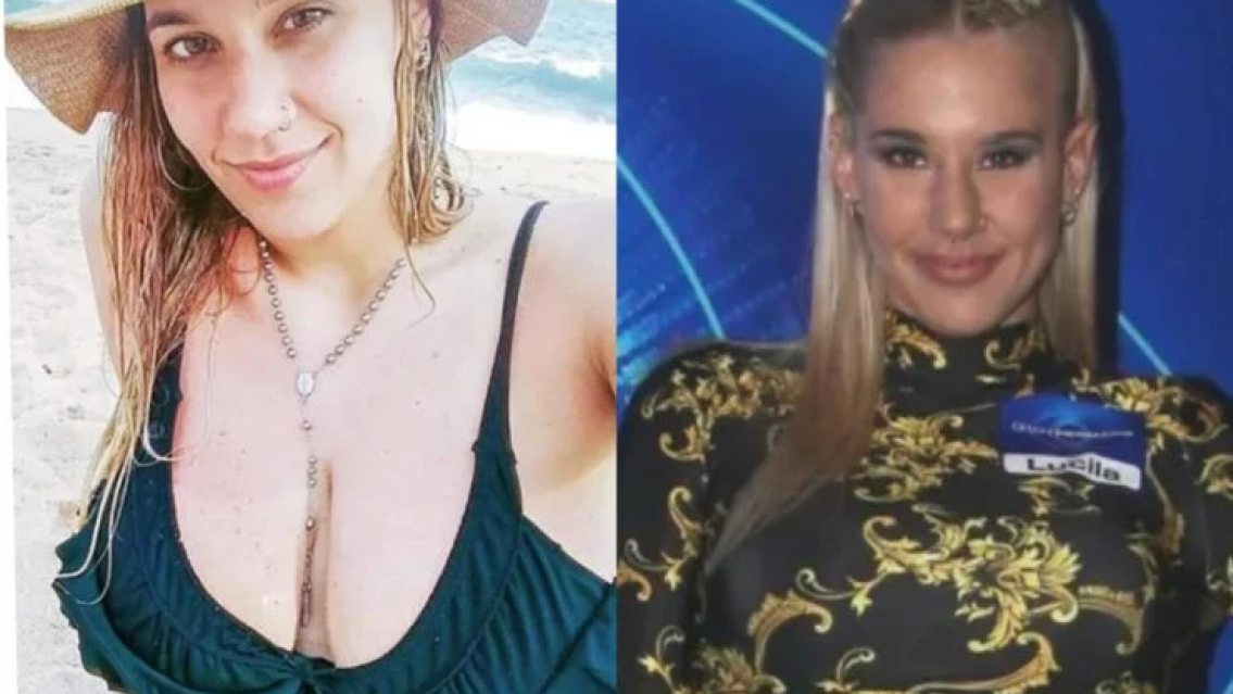 La Tora se animó al "antes y después" según las cirugías que se hizo. Así quedó