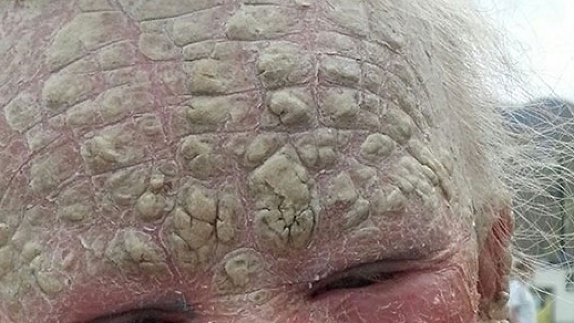 Las enfermedades de piel m�s comunes en los ni�os, a tener cuidado