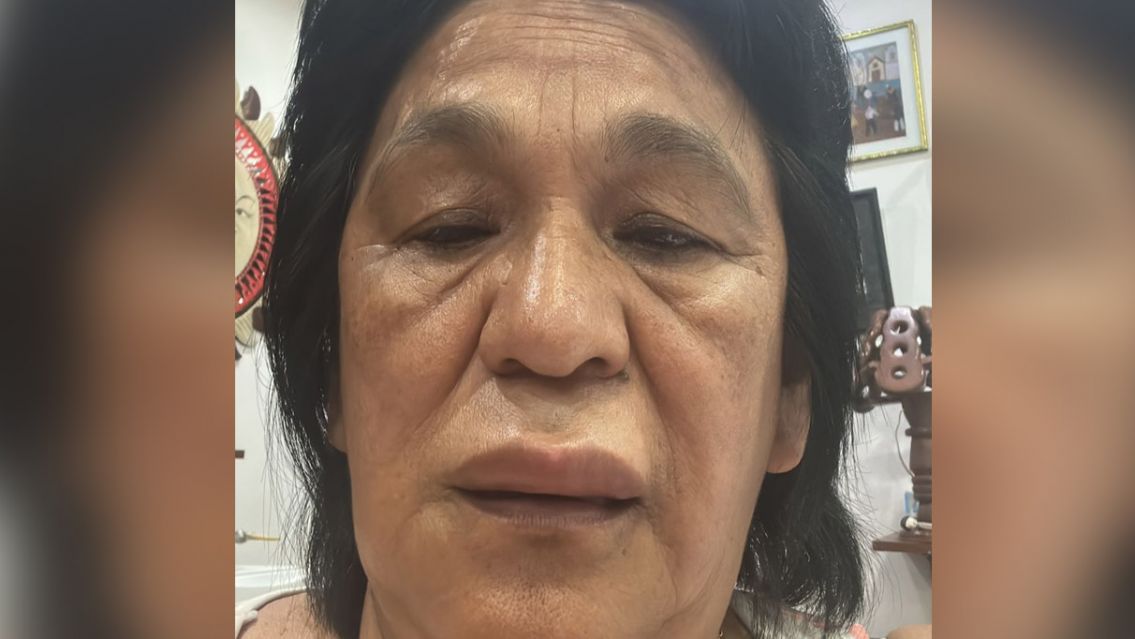 Milagro Sala está grave: su médico exige el traslado inmediato