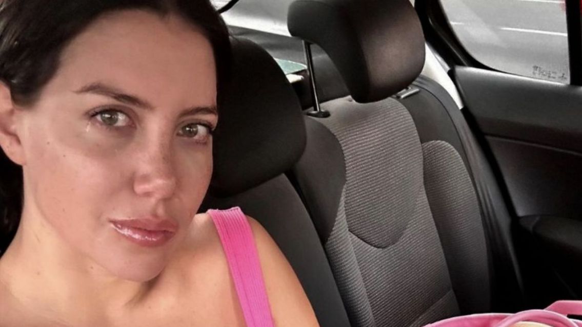 Wanda Nara habló sobre su enfermedad: "Si no te ven sin pelo piensan..."