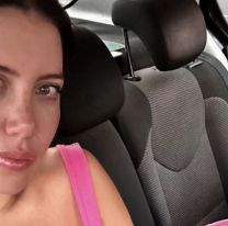 Wanda Nara habl&oacute; sobre su enfermedad: "Si no te ven sin pelo piensan..."