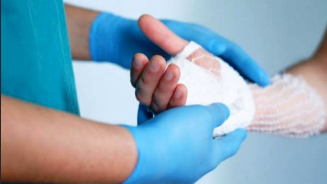 Discutió con su amigo por una campera, lo prendió fuego y quiso escapar