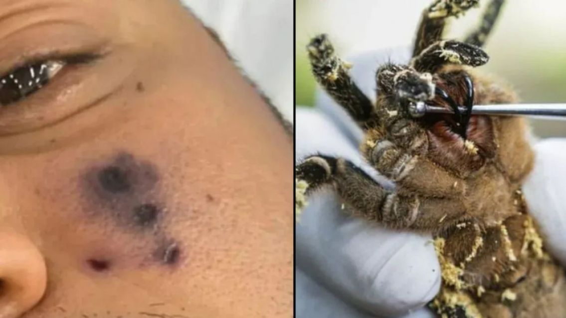 Conmoción: murió un queridísimo cantante por una picadura de araña y los detalles son estremecedores