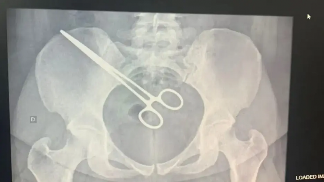 Hizo una visita a la c�rcel, le son� el detector de metales, pensaron que ten�a un arma pero...