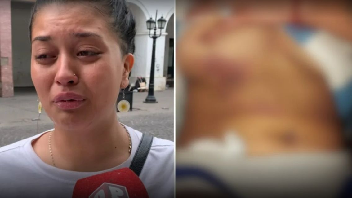 Denunci� que su ex la atropell� con el auto y mostr� las grave heridas [VIDEO]