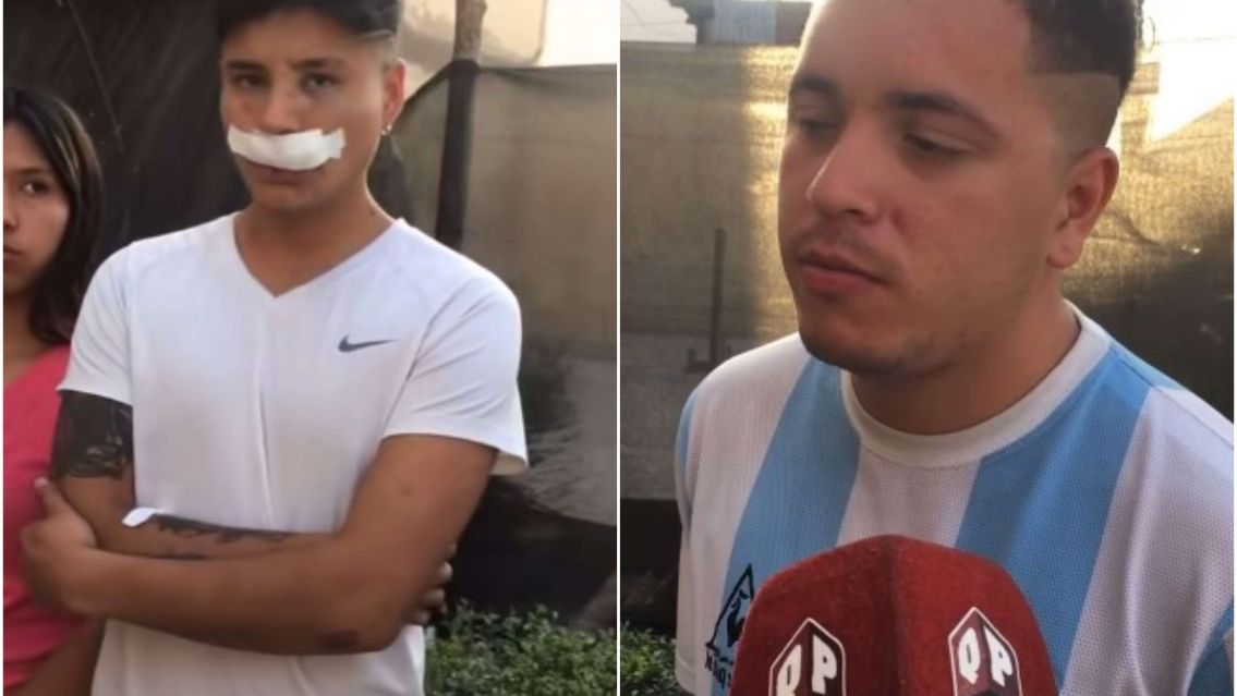 Terrible ataque de rugbiers juje�os: Entre 20 agarraron a un grupo de cuatro chicos