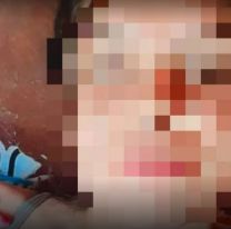 Muri&oacute; una joven de un disparo: estaba embarazada de 5 meses