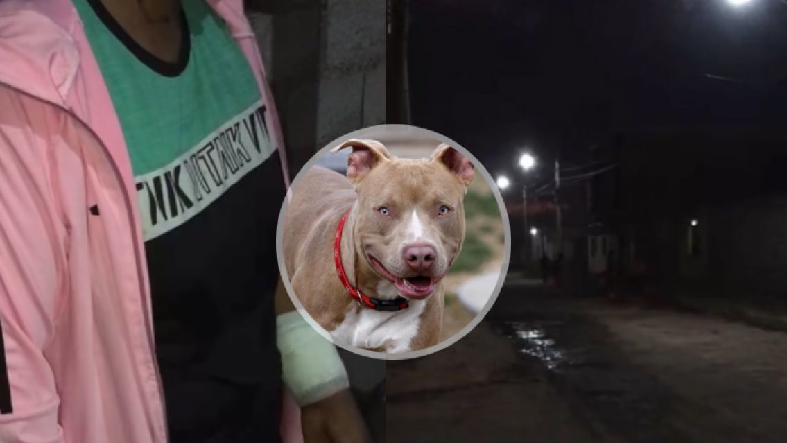 Ataque de pitbulls en Alto Comedero: vecinos piden sanciones para los dueños