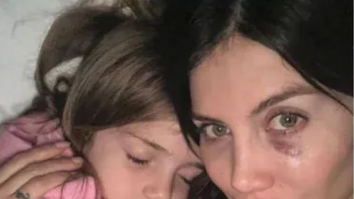 La preocupante foto que subió Wanda Nara a sus redes y generó gran repercusión