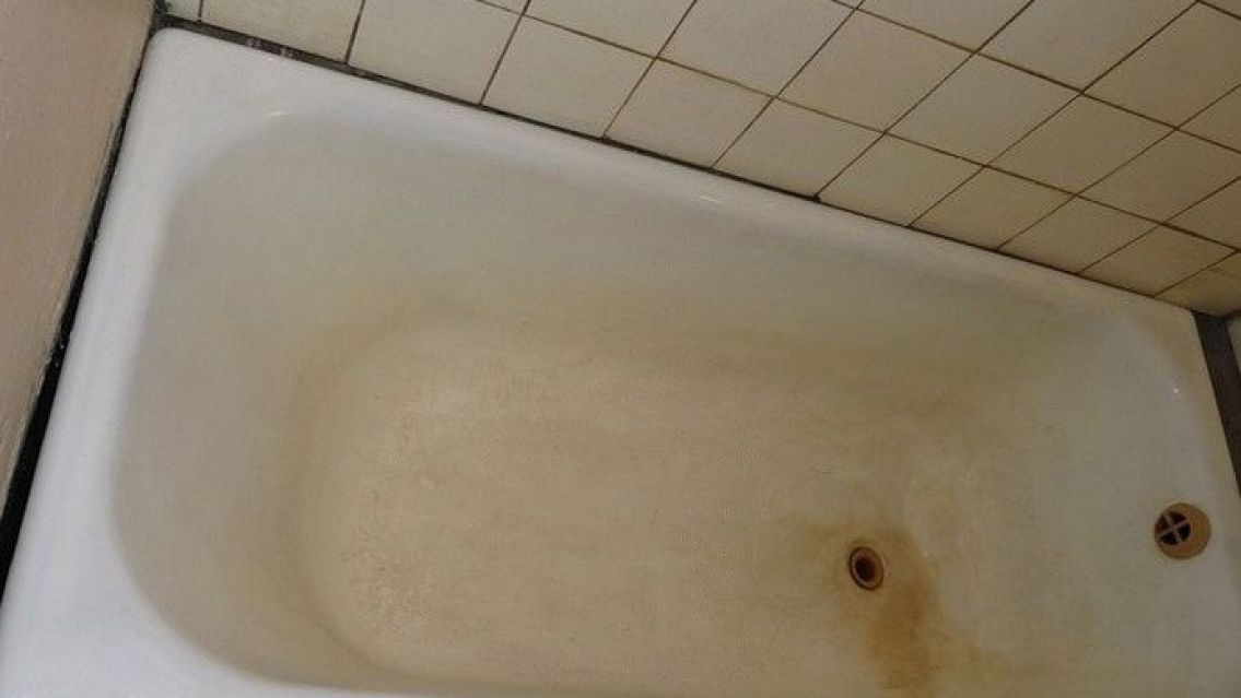 Abuela jujeña no se dio cuenta y metió a su nietita en la bañera con agua hirviendo