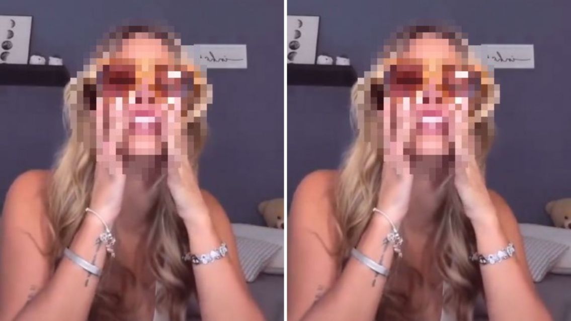 Desfigurada: Julieta Poggio mostr� c�mo le qued� la cara tras caerse de un barco [VIDEO]