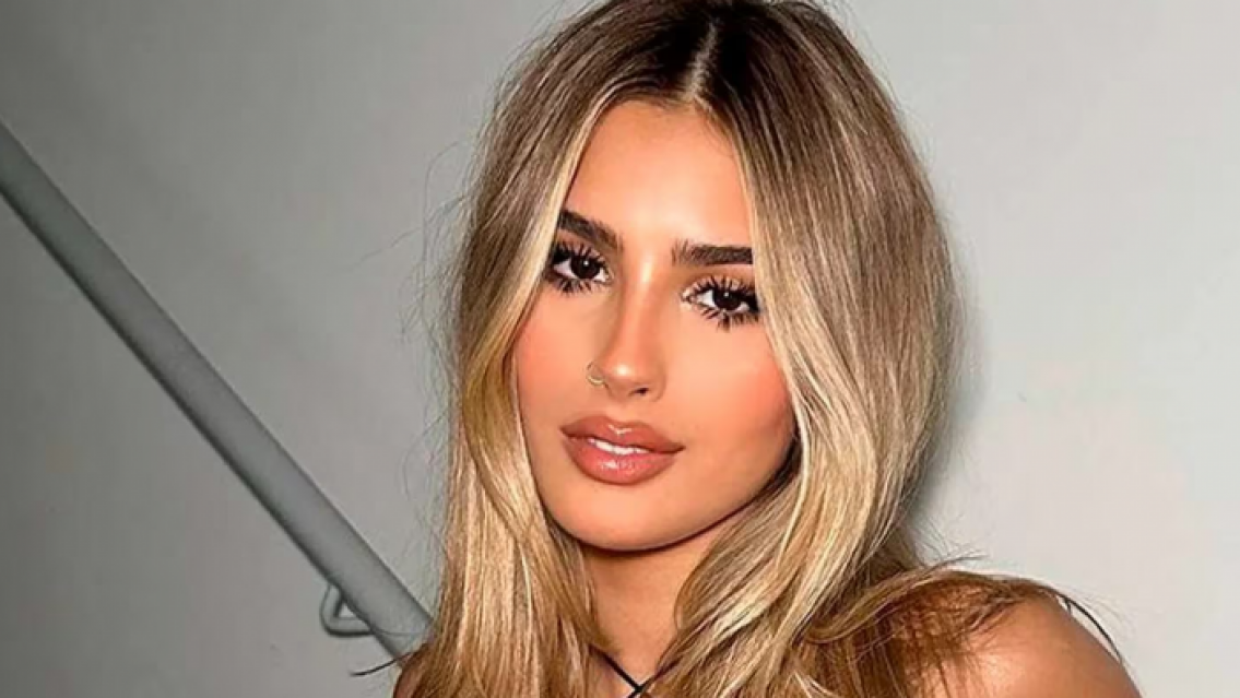 Juli Poggio se oper� y ya la comparan con las Xipolitakis, ���Qu� se hizo?!!