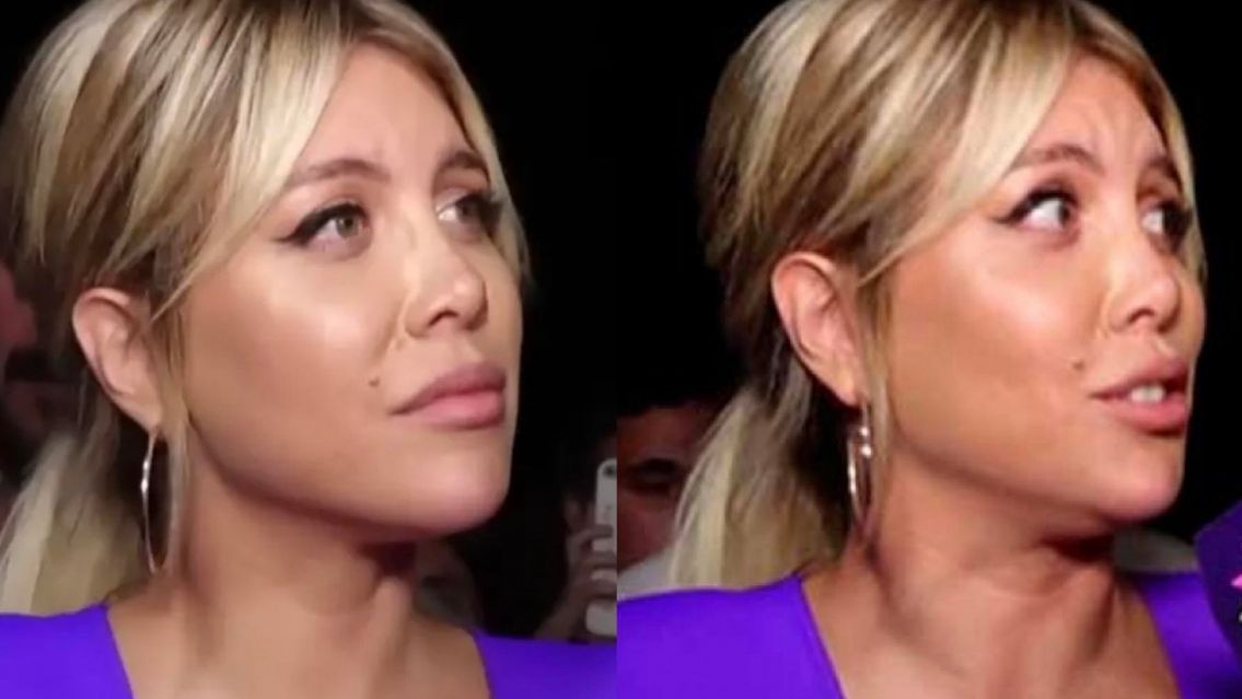 Nunca antes visto: el tratamiento que recibe Wanda para pelearle a la leucemia