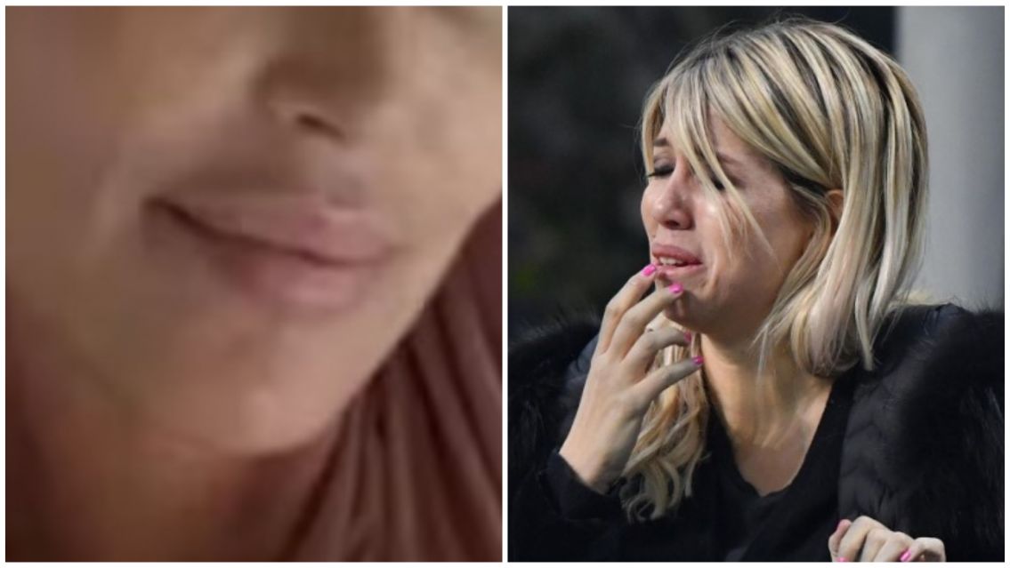 Actriz contó lo fue vivir con leucemia: el dato que asustó a Wanda