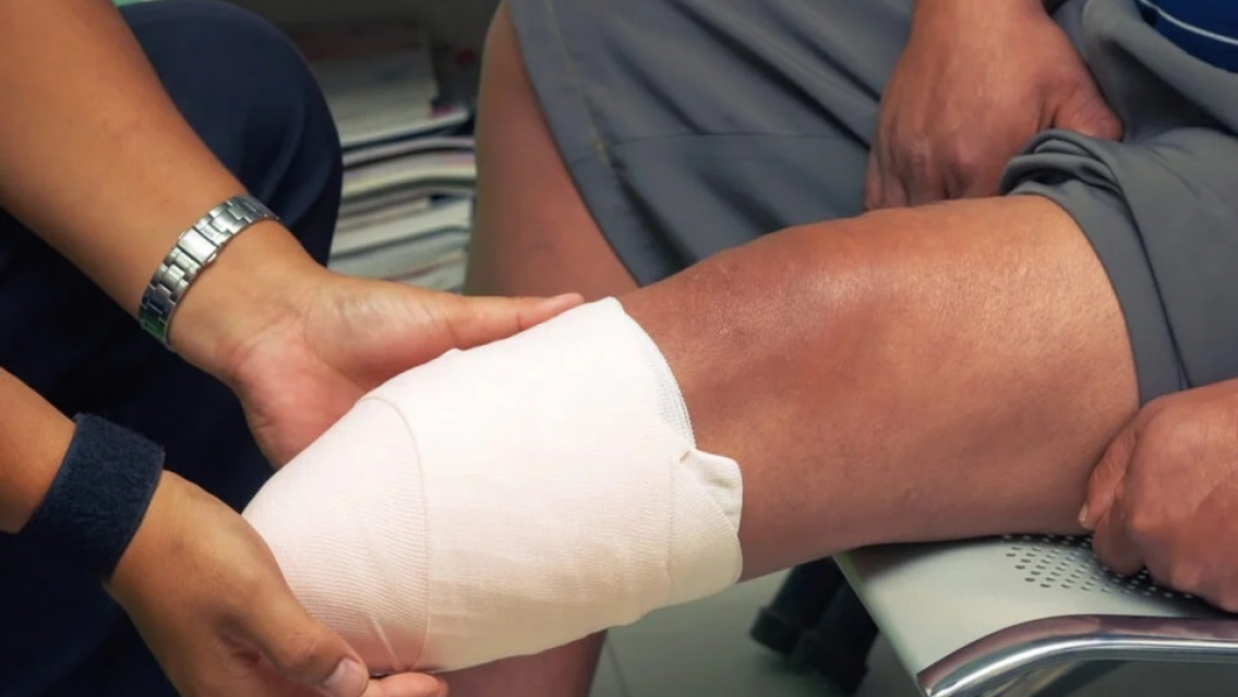 Palpalá: Borracho al volante atropelló y casi mata. A la víctima le amputaron la pierna