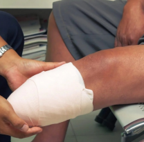 Palpalá: Borracho al volante atropelló y casi mata. A la víctima le amputaron la pierna