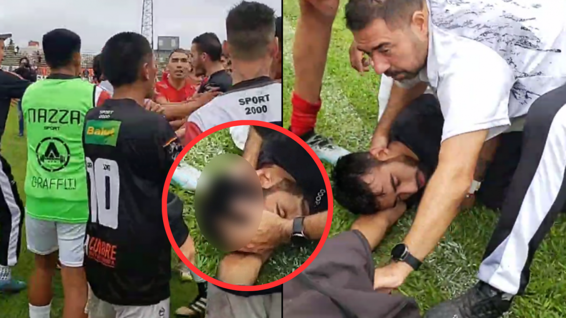 Empujones, pi�as y un jugador con el maxilar quebrado en el Regional Amateur