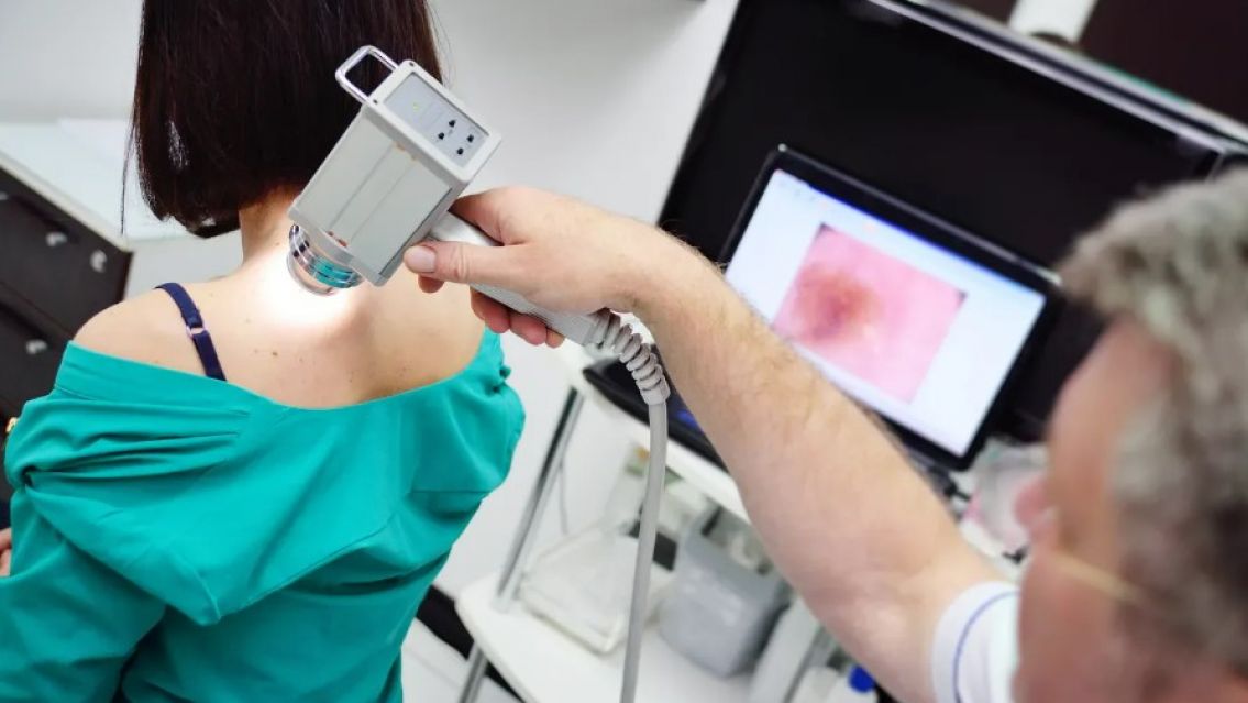 Un equipo argentino desarroll� la primera vacuna contra el c�ncer de piel