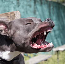 La nena atacada por un pitbull permanecerá en terapia, está con respirador