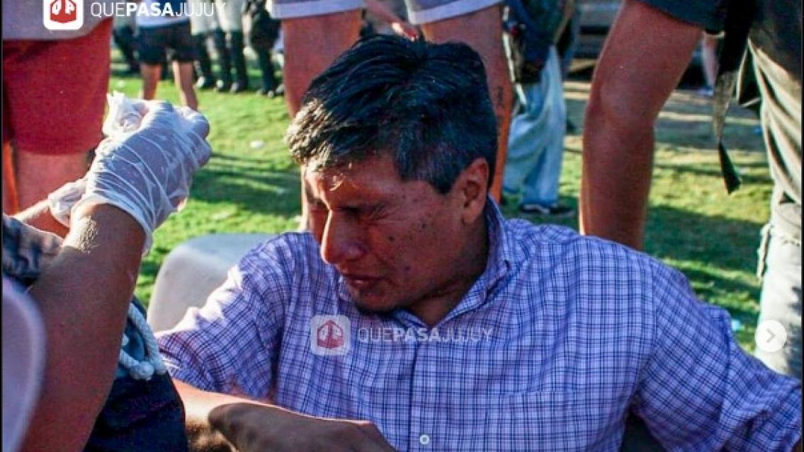 Ley �mnibus: se aplic� el "protocolo antipiquetes" y le tiraron gas pimienta a Alejandro Vilca