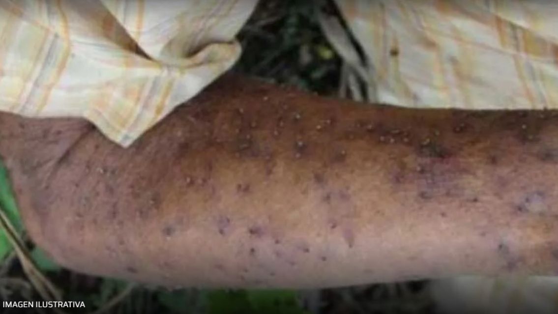 Abejas atacaron a un abuelito y lo mataron: fue mientras fumigaban contra el dengue