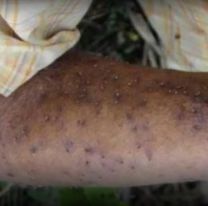 Abejas atacaron a un abuelito y lo mataron: fue mientras fumigaban contra el dengue