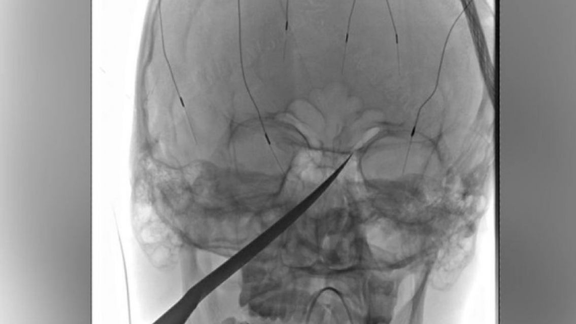 Juje�o discuti� con su hermano y uno termin� irreconocible en el hospital