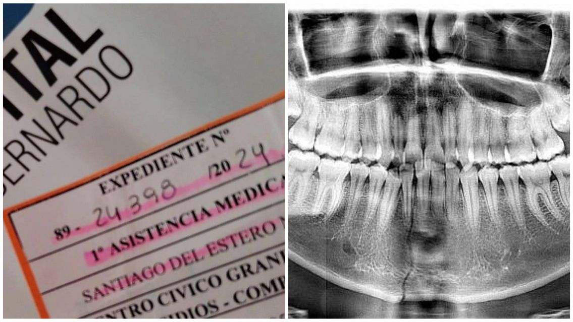 Lo asaltaron y le reventaron la mand�bula: necesitan dos millones para operarlo