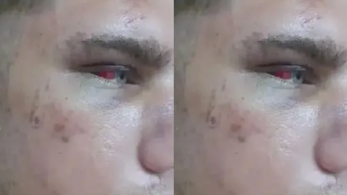 Lo molieron a palos en el festejo del "UPD", �ltimo Primer D�a