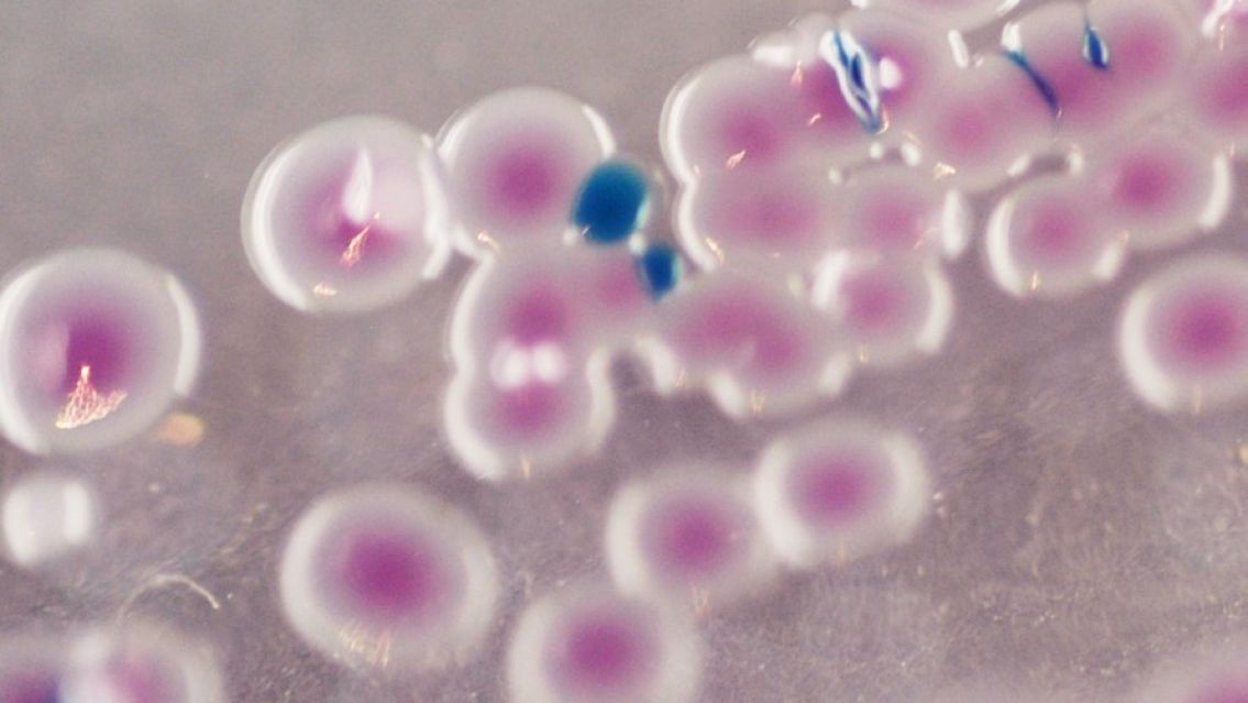 Un peligrosa bacteria causó un brote en Chile: ¿qué es el Vibrio parahaemolyticus?