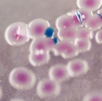 Un peligrosa bacteria causó un brote en Chile: ¿qué es el Vibrio parahaemolyticus?