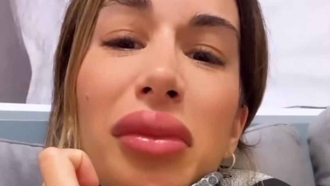 �La reconoc�s? Es Estefi Berardi, as� le qued� la boca. En las redes la fulminaron