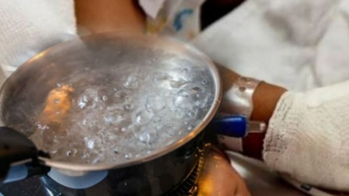 Jujeñita de 2 años quedó internada luego de quemarse con una olla de agua hirviendo