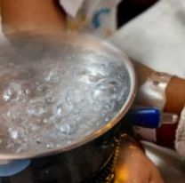 Juje&ntilde;ita de 2 a&ntilde;os qued&oacute; internada luego de quemarse con una olla de agua hirviendo