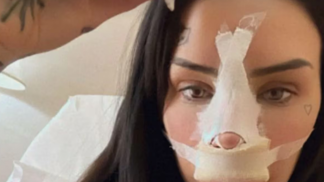 "Parece un monstruo", lo que se hizo en la cara Cande Tinelli