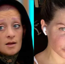 Diagn&oacute;stico de Leucemia, c&oacute;mo son los casos de Wanda Nara y Furia de Gran Hermano