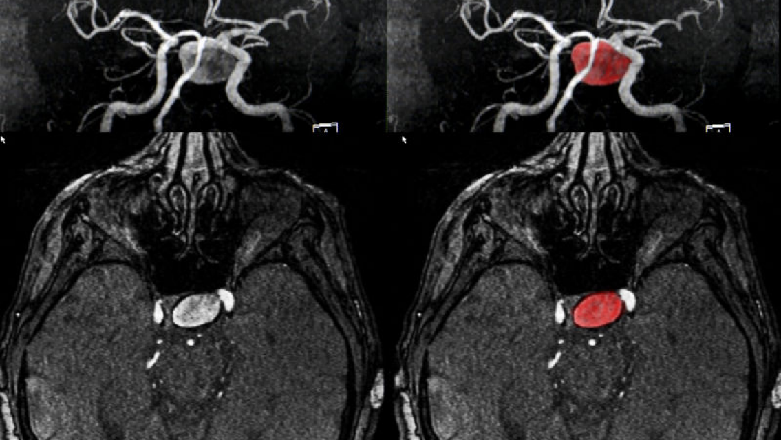 Creía que tenía resaca, fue al médico y le dijo que "le queda un año de vida"