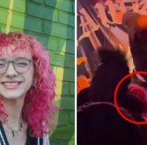 Fue a un recital, el cantante se le tiró encima y terminó en terapia intensiva: "Fue una tragedia"