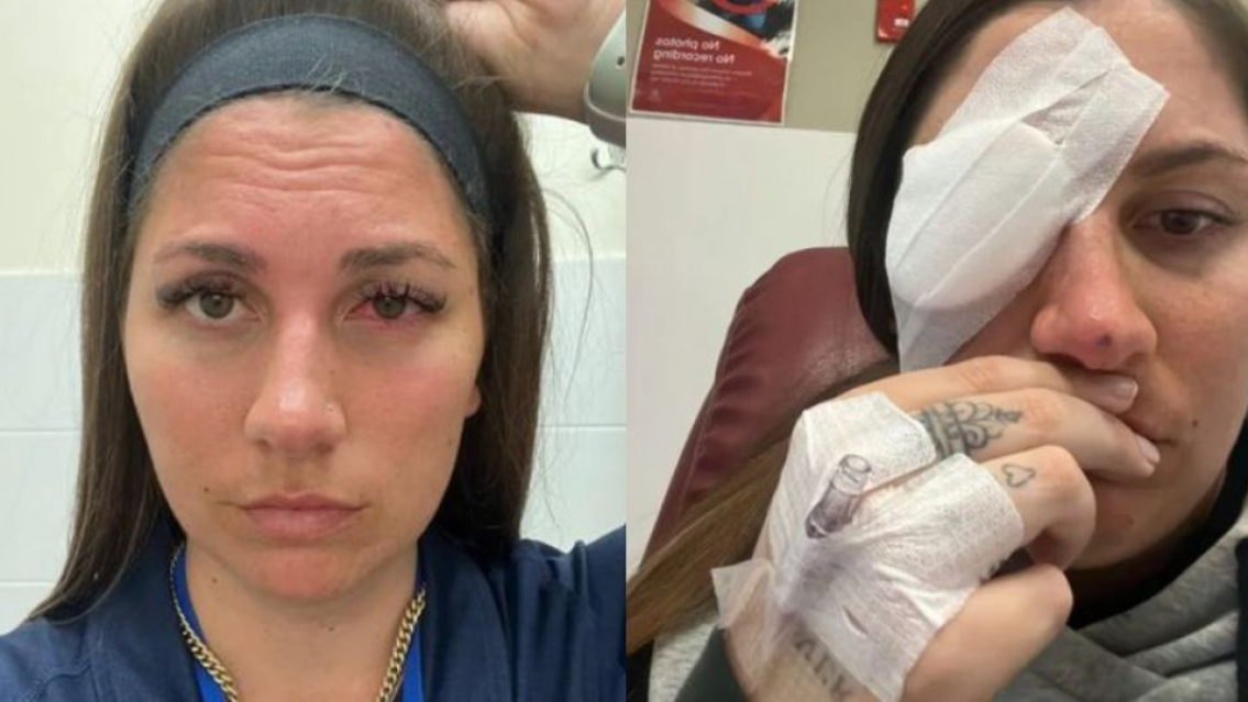 Pestañas postizas y cáncer, el terrible caso de una joven de 28 años