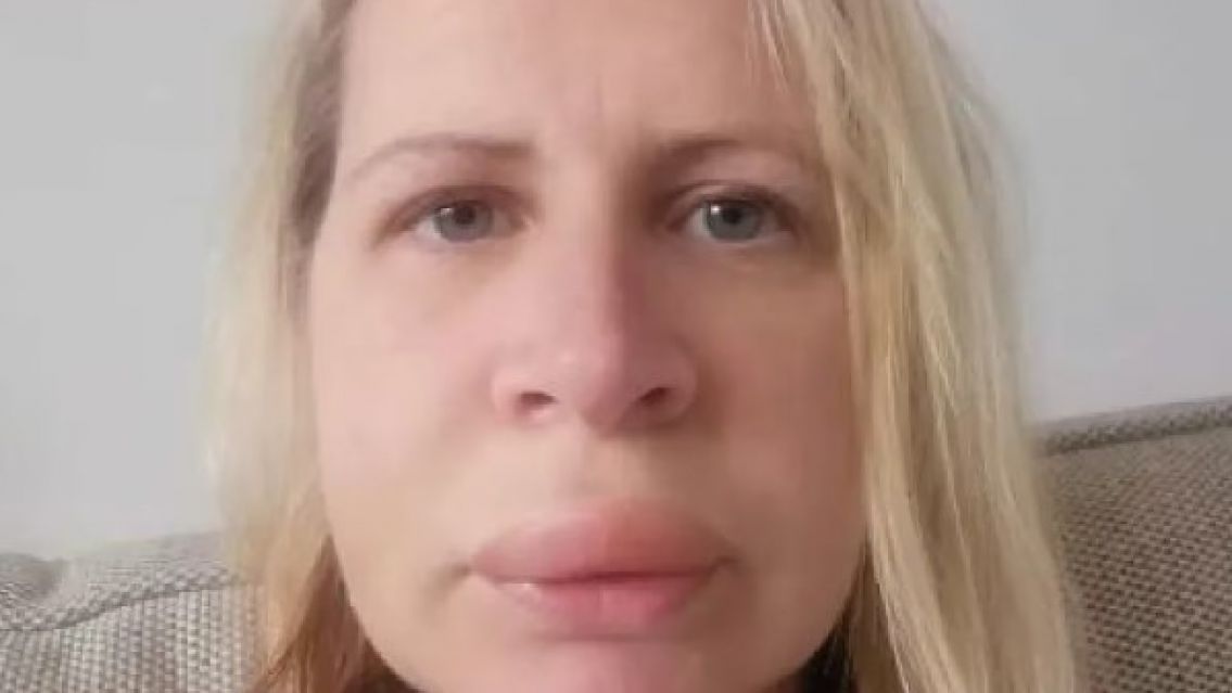 Fue al dentista y la desfiguraron de por vida: "Todavía tengo pesadillas"