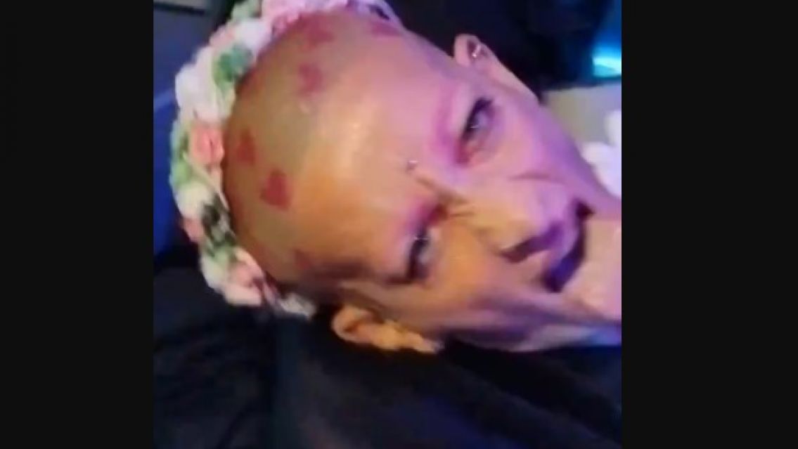 Furia fuera de si: Así atacó a los seguidores de Martín