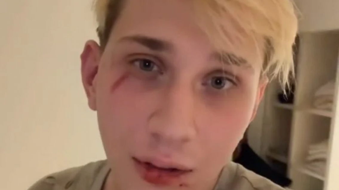 Inesperada reacci�n de Tiago PZK, habr�a agredido salvajemente a un streamer