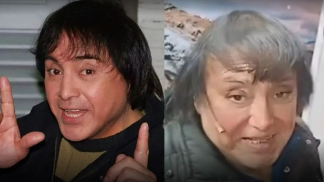 Habl� Ricky Maravilla y confes� qu� se hizo en la cara: "Pusieron un..."