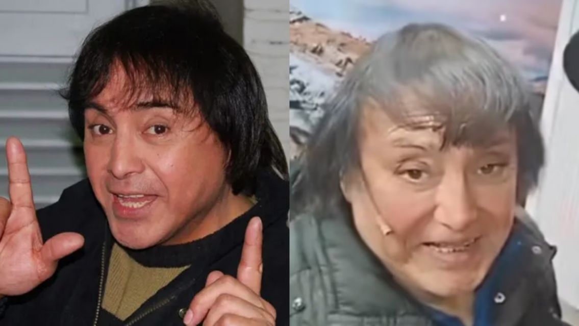 Habló Ricky Maravilla y confesó qué se hizo en la cara: "Pusieron un..."