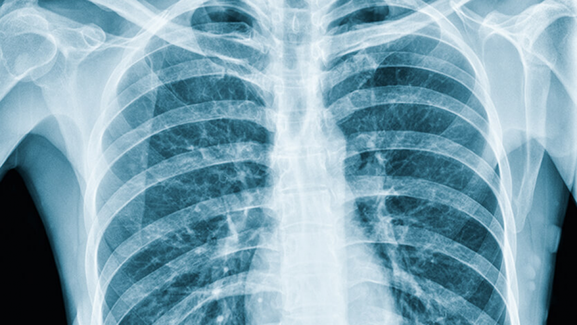 Pas� el horario de visita y se dieron con "la sorpresa" en la c�rcel: 100 c�psulas