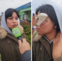 La desfiguraron, norteña relató el horror que vivió a la salida del boliche