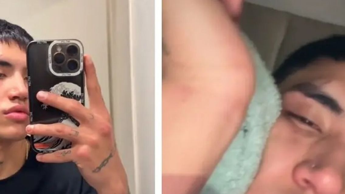 Fue a un boliche de Buenos Aires y le destruyeron la cara a golpes: "los envidiosos"