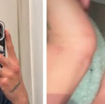 Fue a un boliche de Buenos Aires y le destruyeron la cara a golpes: "los envidiosos"