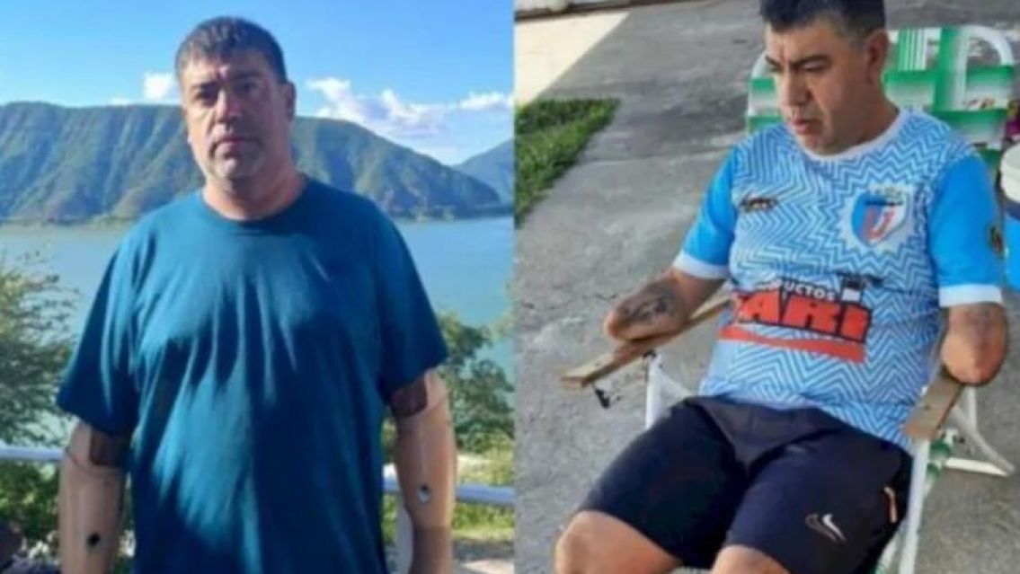 Desesperado pedido de ayuda: le robaron sus prótesis ortopédicas en Jujuy